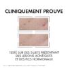 vichy normaderm sérum anti imperfections probio bha. peau grasse acnéique | 30ml
