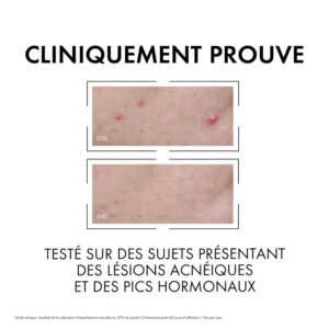 vichy normaderm sérum anti imperfections probio bha. peau grasse acnéique | 30ml