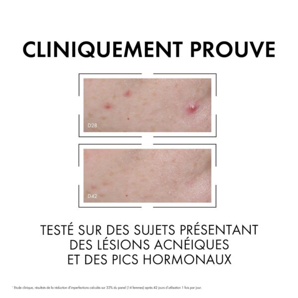 vichy normaderm sérum anti imperfections probio bha. peau grasse acnéique | 30ml
